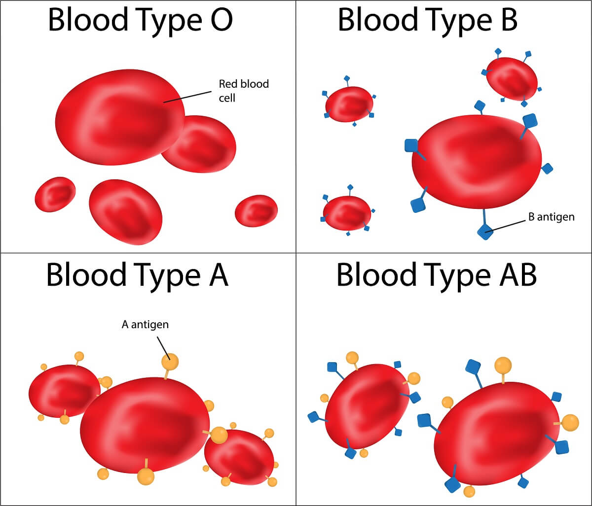 5 Ways to Understand Codominance in Blood Types