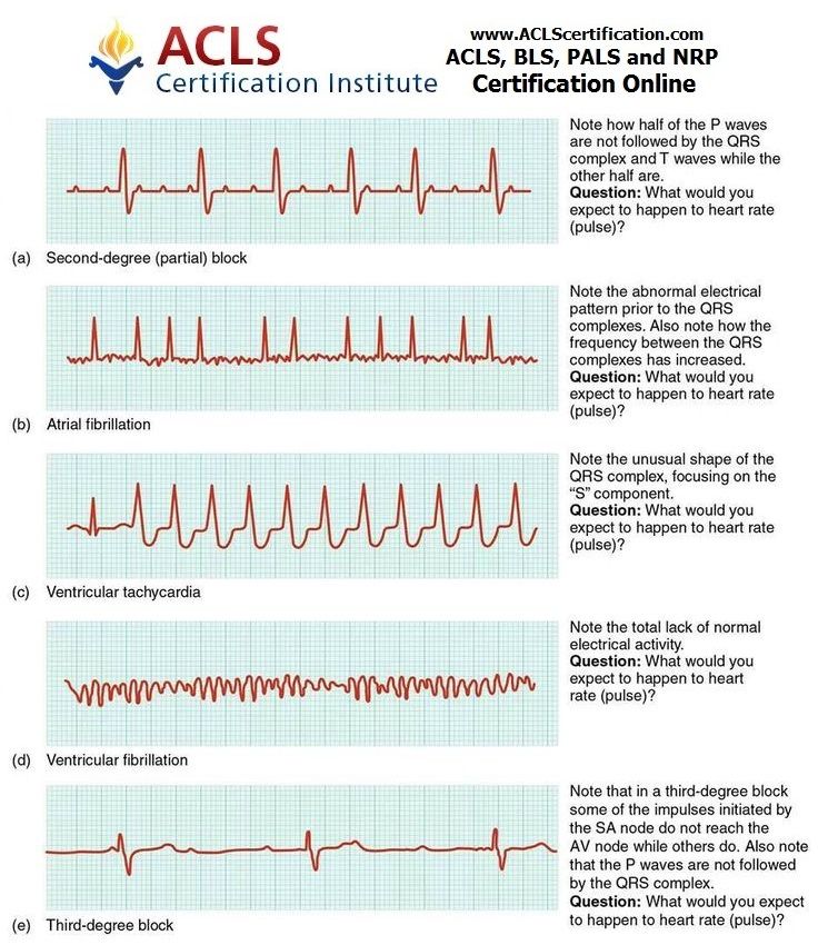 Ekg Practice Worksheet For Nurses