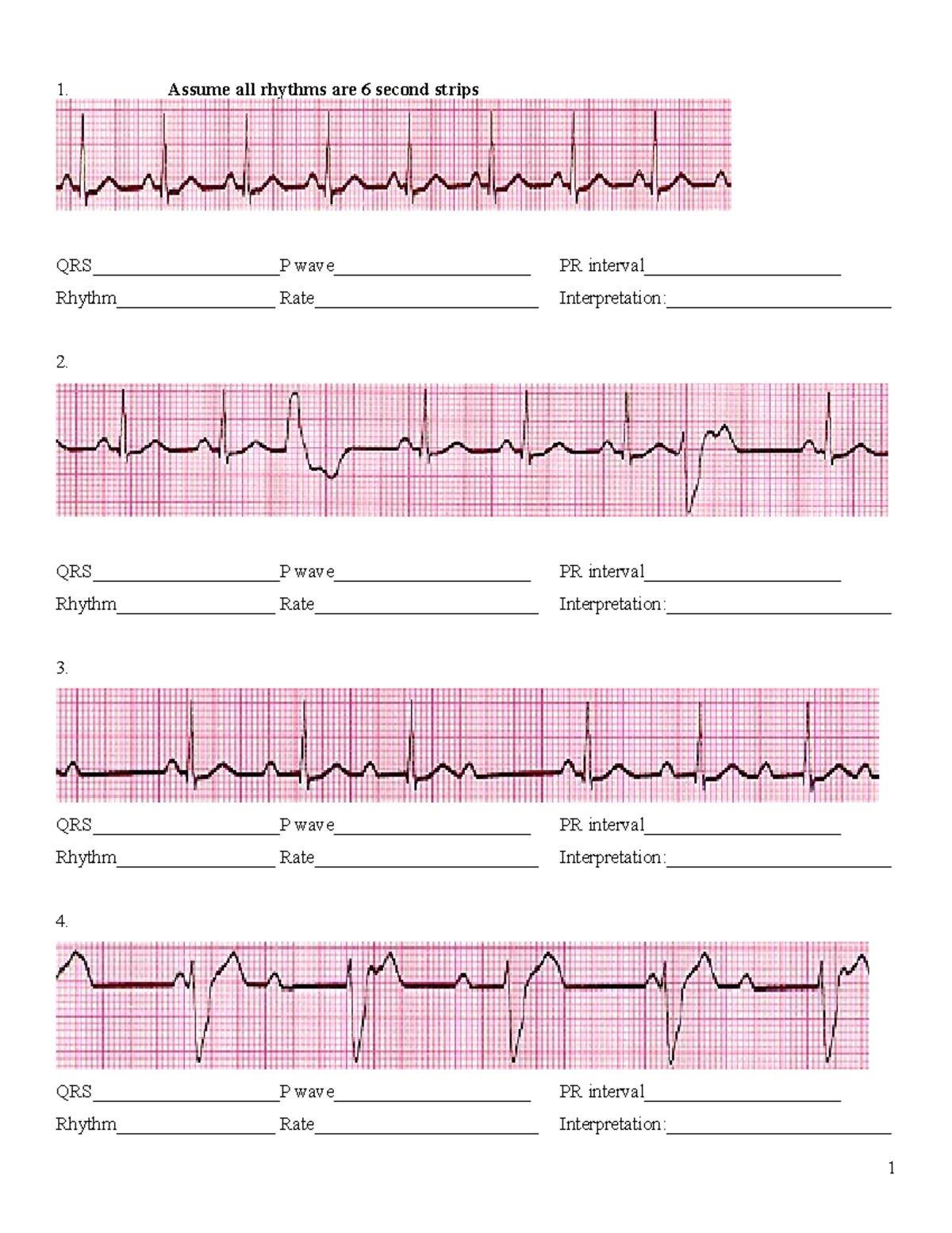 Mastering EKGs: Practice Worksheets with Answers